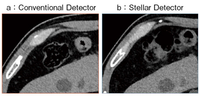 図1　Conventional Detector（a）とStellar Detector（b）の拡大画像の比較
