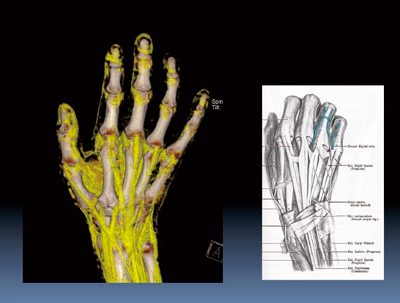 図2　正常伸筋腱（手背側）1）
