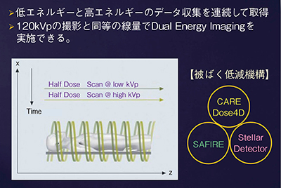 図1　SOMATOM Definition EdgeによるDual Energy Imaging