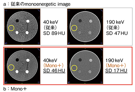 図1　従来のmonoenergetic image（a）とMono＋（b）のSD値の比較