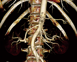 図1　70kVを用いた腎臓のダイナミックスタディVR画像