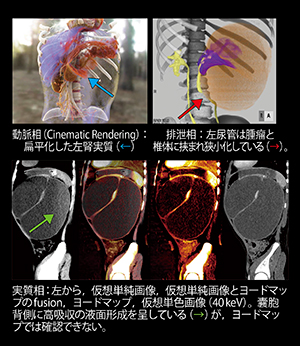 時相毎に撮像エネルギーを最適化した小児腎ダイナミック撮像
