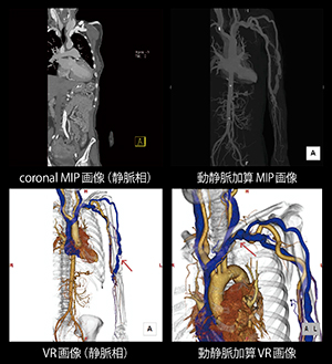 時相毎に撮像エネルギーを最適化した小児腎ダイナミック撮像