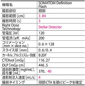 心電同期4D撮影による脳動脈瘤ブレブ評価