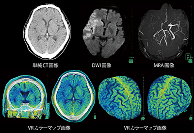 脳色図：VRカラーマップ画像