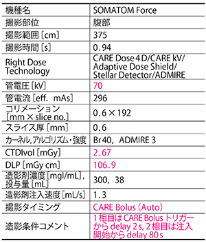 腎移植前小児患者に対する包括的全腹部動静脈撮像