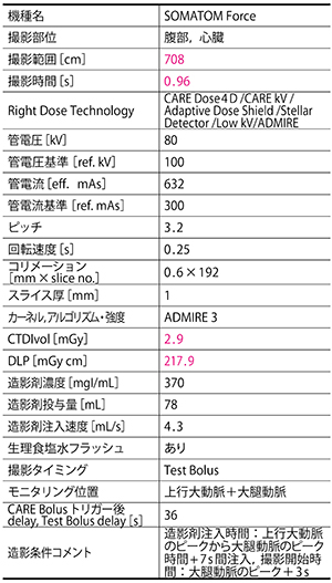 冠動脈解離とSMA解離を同時に描出できた緊急造影CT