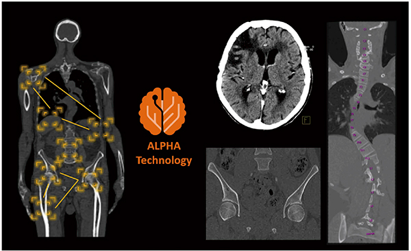 図3　ALPHA Technologyを用いて作成したMPR画像 患者個々の解剖学的なランドマークを認識し，自動的に当該部位の軸位に沿った角度に調整してMPRを作成できる。