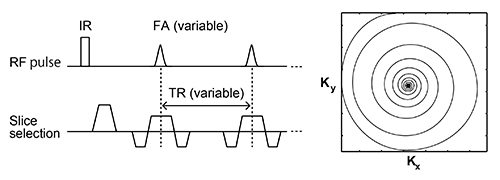 図2　IR-bSSFP法とVDSの概略図