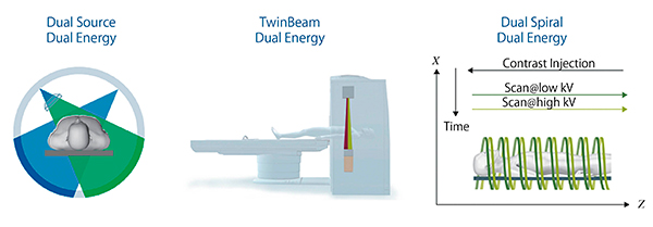 図3　Dual energyイメージングを可能とする3つの撮影モード
