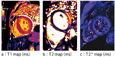 図1　MyoMapsによる各種パラメータマップ T1値，T2値，T2＊値が画像のピクセル値となって表示される。
