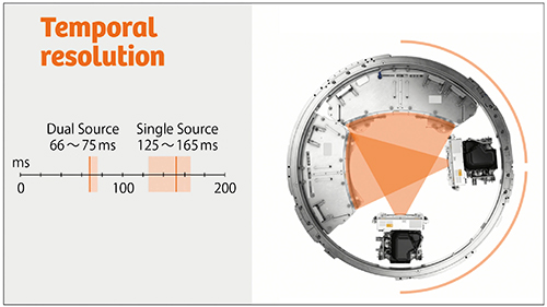 図1　高い時間分解能を生かした心臓CT Dual Source CTでは66ms，または75msによる圧倒的な時間分解能の高さによって，動きによるアーチファクトの影響を抑制した動態評価が可能となっている。