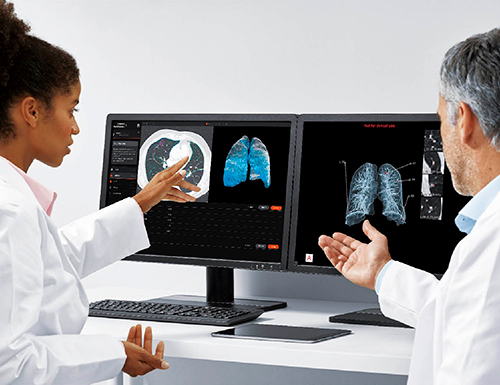 図1　胸部CT画像に対するAI画像診断支援ソフトウエアの解析結果例 肺気腫の領域をスキャンした結果（左モニタ）と肺結節の検出結果（右モニタ）