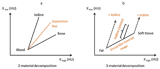 図5　Dual energy解析 a：2-material decomposition　b：3-material decomposition
