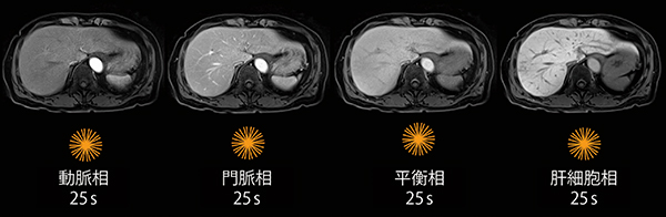 図2　StarVIBEによる肝臓ダイナミック撮像 （画像ご提供：南風病院様）
