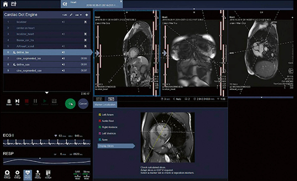 図1　‌Cardiac Dotの画面 心臓の基準撮像断面である二，三，四腔像や短軸像に加え，大動脈弁や僧帽弁の撮像断面を自動決定することが可能である（XA）。