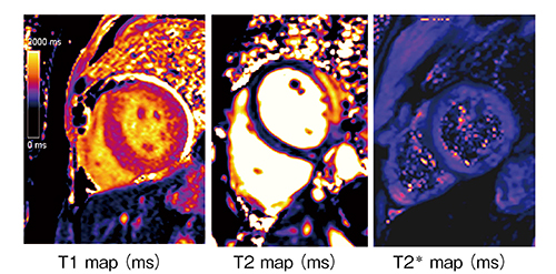 図3　‌MyoMapsによる各種定量値マップ T1値，T2値，T2＊値が画像のピクセル値となって表示される。