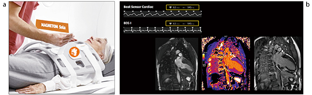 図1　Beat Sensorのセッティングと各種画像 Beat Sensorでは，心電図の準備が不要で，受信コイルを患者にセットするだけで心拍同期撮像の準備が完了する（a）。Beat Sensorにより，ECGによって得られる心拍と同様の同期信号が得られている （b 上段）。Beat Sensorを使用した心臓シネ画像，T1map，遅延造影を示す（b 下段）。