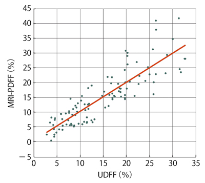 図2　UDFF/MRI-PDFF相関