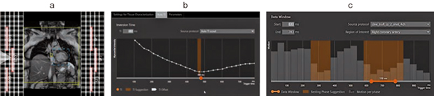 図1　AutoMate Cardiacの概要 a：Auto Positioning 概要図 b：Auto Resting Phase 概要図 c：Auto TI 概要図 （参考文献3）より引用転載）