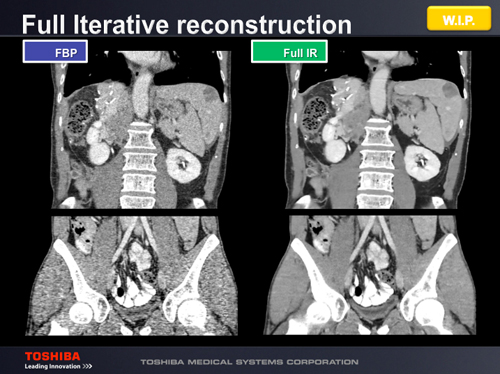 Full Iterative reconstruction
