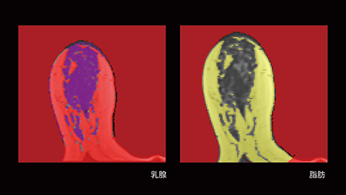 MRI画像による乳腺密度測定 Volume Segmentation