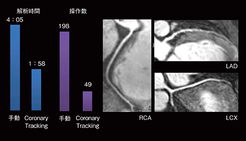 冠動脈解析を簡便に MR Coronary Tracking