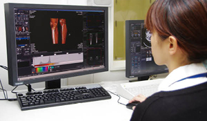 CT更新に合わせ導入したVitreaは、サブトラクションなどの自動処理により省力化を実現