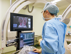 TACEの際にHyperViewerにて腫瘍血管の走行や分岐部などを確認