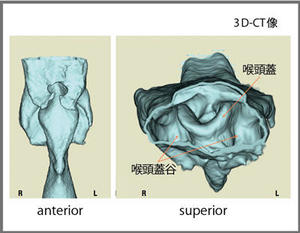 図5　咽頭と喉頭の形態（上下方向，中咽頭レベル）