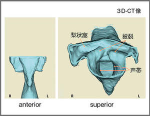 図6　咽頭と喉頭の形態（上下方向，下咽頭レベル）