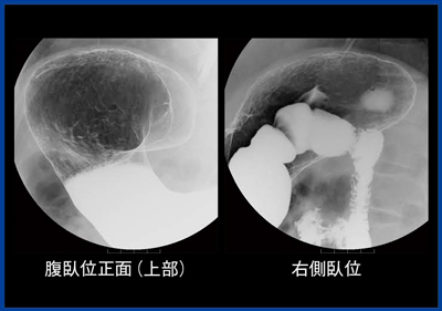 図5　胃X線検査の基準撮影法