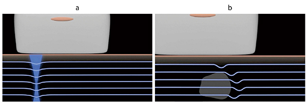 図2　SWEにおける剪断波の伝播速度の変化 a：プッシュパルスによって組織の一部を変形させる。 b：腫瘍などの硬い障害物では伝播速度が速くなる。