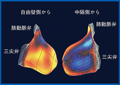 図6　肺高血圧症の右室の3Dストレイン解析カラー画像