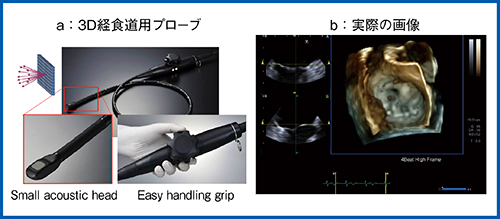 図11　3D経食道用プローブ（a）と実際の画像（b）
