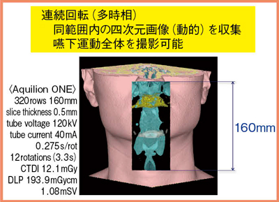 図1　嚥下領域のボリュームスキャン