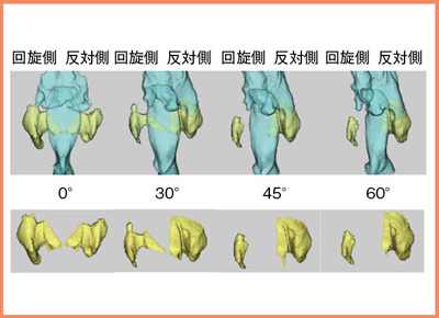 図3　頭部回旋による梨状窩の形態変化