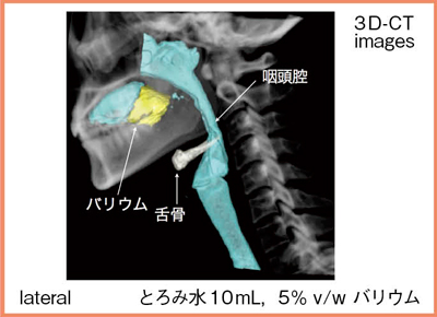 図4　ボリュームスキャンによる嚥下動態