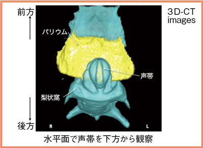 図5　嚥下中の声帯の動態を観察可能