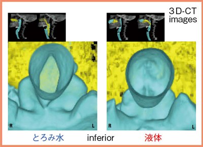 図6　物性による声帯の動態変化