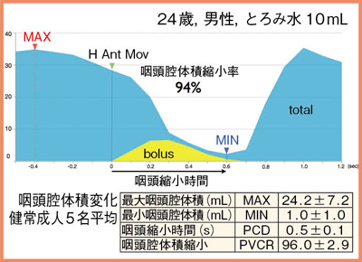 図8　咽喉頭腔と食塊の体積変化（健常例）