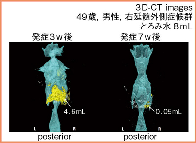 図9　リハビリテーション中の経時的変化