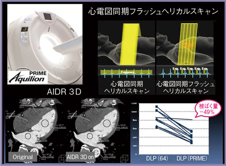 図1　冠動脈CTAにおけるAquilion PRIMEの優位性
