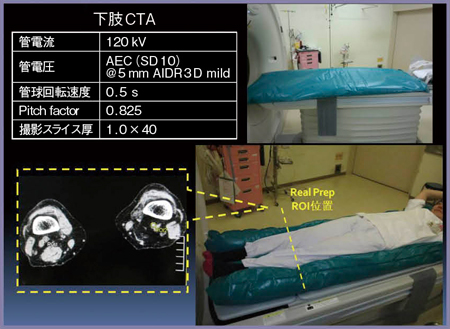 図9　下肢CTA撮影時の固定の工夫