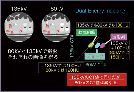 図1　ファントムを用いたDual Energy解析