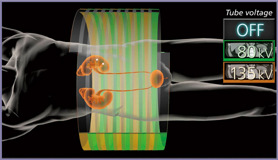 図6　Dual Energy Scanのスキャン方法