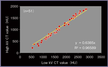 図9　シュウ酸カルシウム＋カーボネートアパタイト混合結石のDual Energy 解析結果