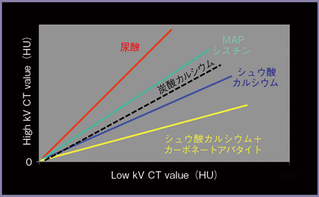 図11　Dual Energy Scanによる尿路結石の物質弁別の可能性