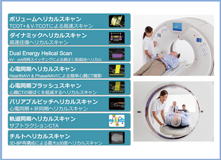 Aquilion PRIMEのヘリカルスキャン技術