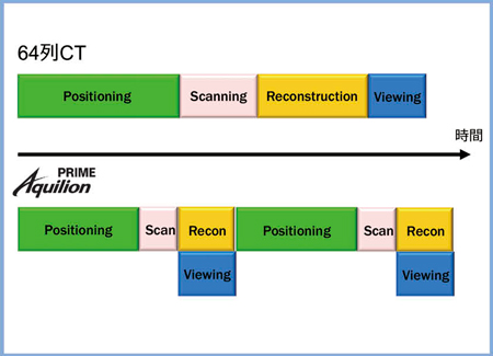 Aquilion PRIMEのワークフロー全体の高速化